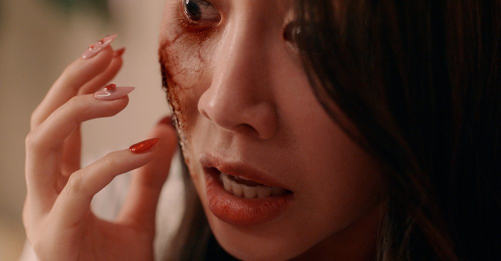 女子触碰脸颊，眼下皮肤出现大片剥落伤痕。